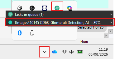 
Location of the queue in the bottom-right corner. Clicking the Visiopharm icon opens the queue, where the progress of the batch analysis can be monitored.
