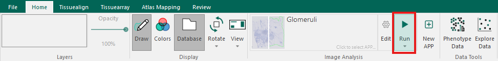 Running the APP from the ribbon