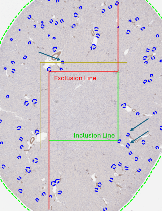 Example of a counting frame (red and green) applied to a glomeruli detection task. The glomeruli marked by the blue arrows illustrate examples of annotation objects that would be counted more than once if counting were based on the FOV (yellow) rather than the counting frame. 