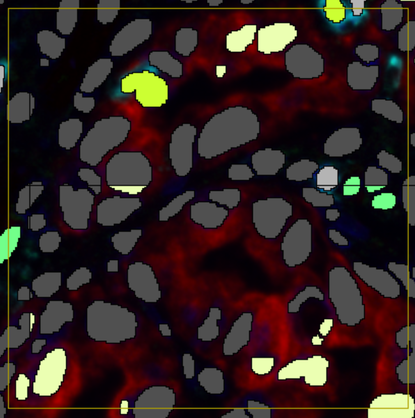 Example illustrating why the placement of the counting frame in the post processing list is important. Both a Change by Intensity step and a counting frame are applied, but the Change by Intensity step is applied before the counting frame. Several label objects are therefore split by the FOV. As a result, the average intensity of one part of a label object may satisfy the change criterion while the other part does not, leading to partially changed label objects.
