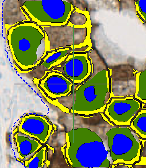 Objects seperated, Separate object surroundings, surroundings width = 3µm