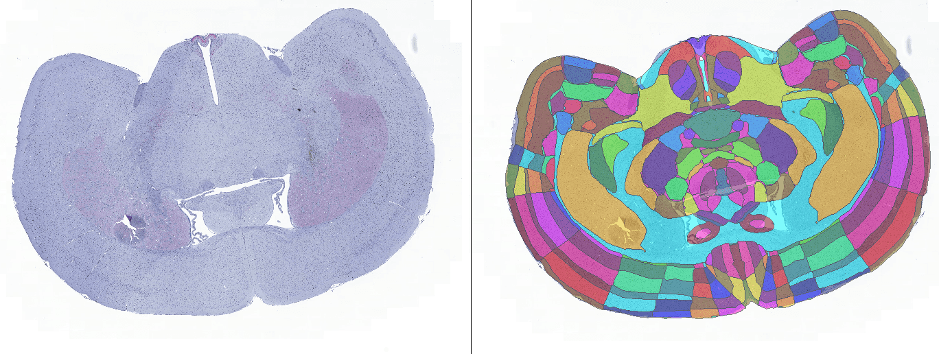 Left:Brain section, Right: Brain section with fitted Atlas