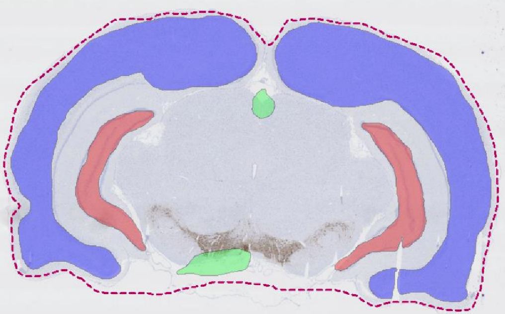 Example of annotations that can be used for training a Deep Learning classifier with Context Aware Region Mapping.   
The ROI outlines relevant tissue with the context needed to segment the areas of interest.