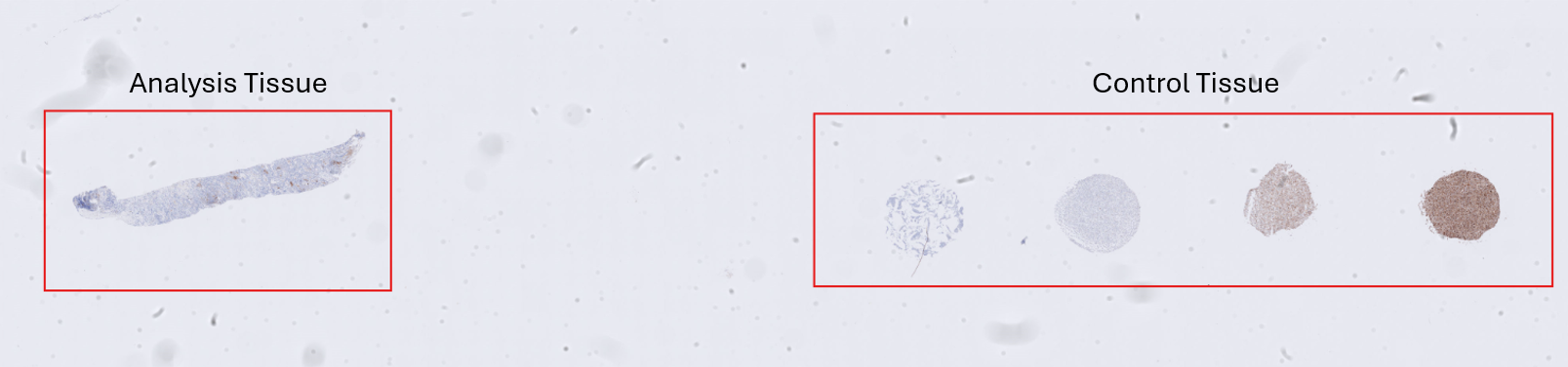 Target image containing analysis tissue (left), which should be classified as tissue, and control tissue (right), which should be classified as background.