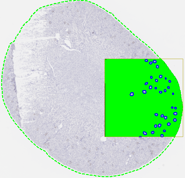 Example: Previewing the result of a Glomeruli detection APPs