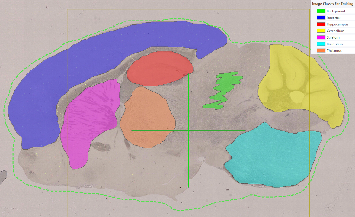 Example of labels that can be used for training a Deep Learning APP with Context Aware Region Mapping.   
The ROI outlines relevant tissue with the context needed to segment the areas of interest.