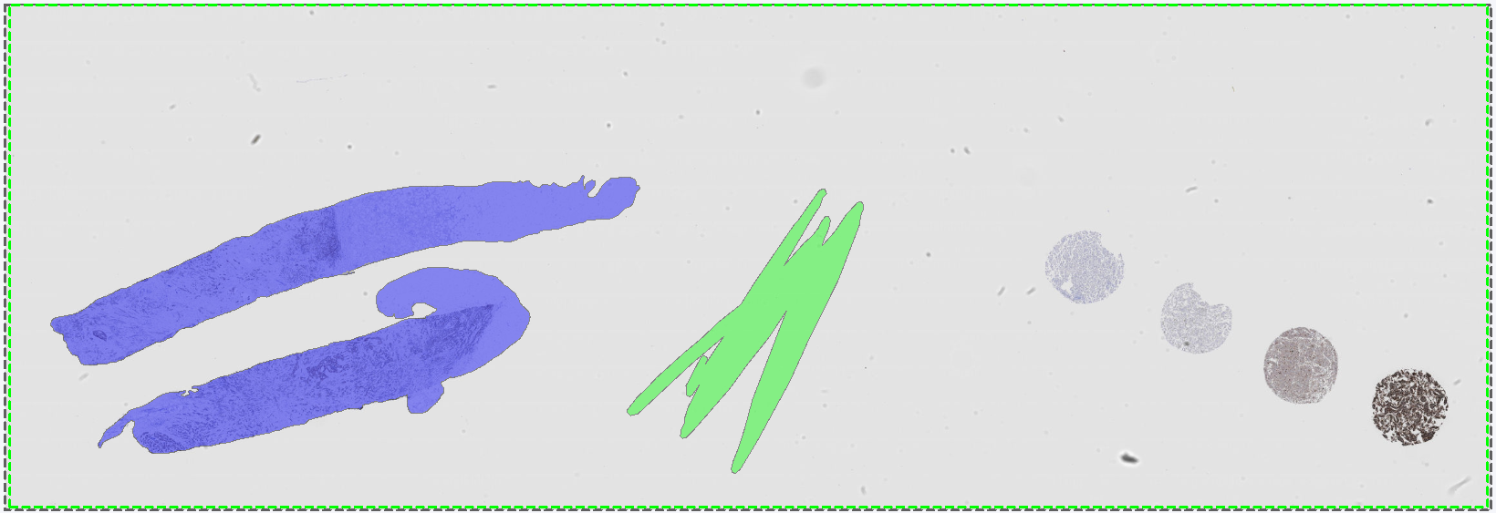 Training labels e.g., tissue (blue) and background (green), drawn on the training image.