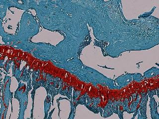 Original Image (Knee section, LT slice).