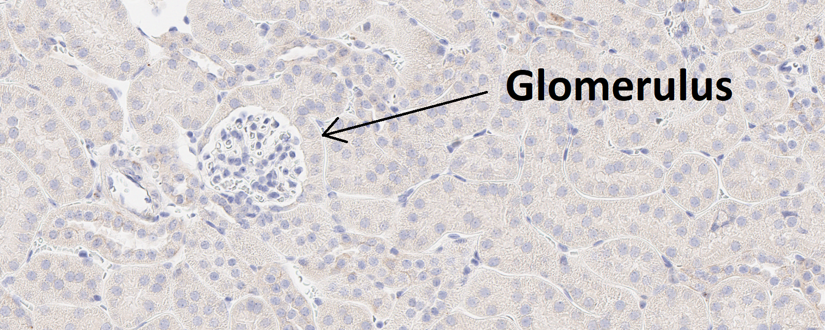 Detecting glomeruli shown in this image is the example task (Kidney CD68).