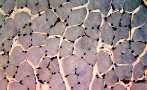 Original image (Muscle Tissue)
