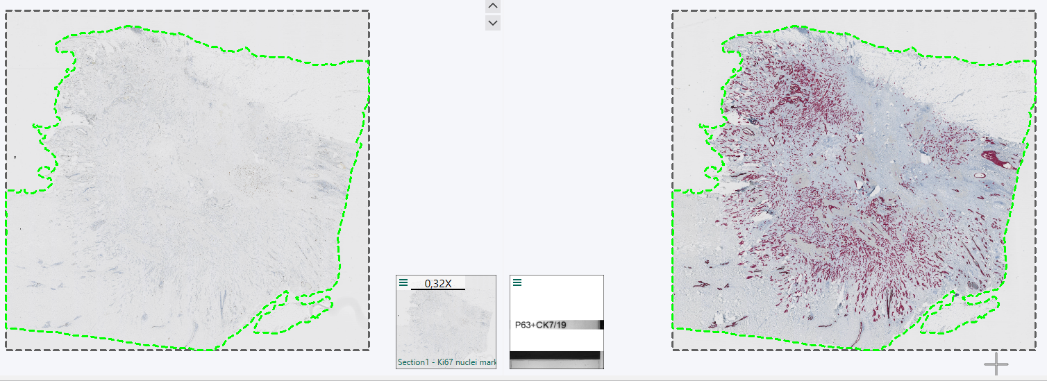 Section 1 and Section 2 scans after tissue alignment but before saving the layer data.