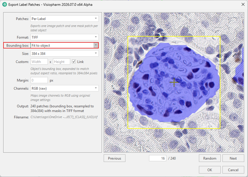 Export Glomeruli Label Patches using Fit to object Bounding Box.