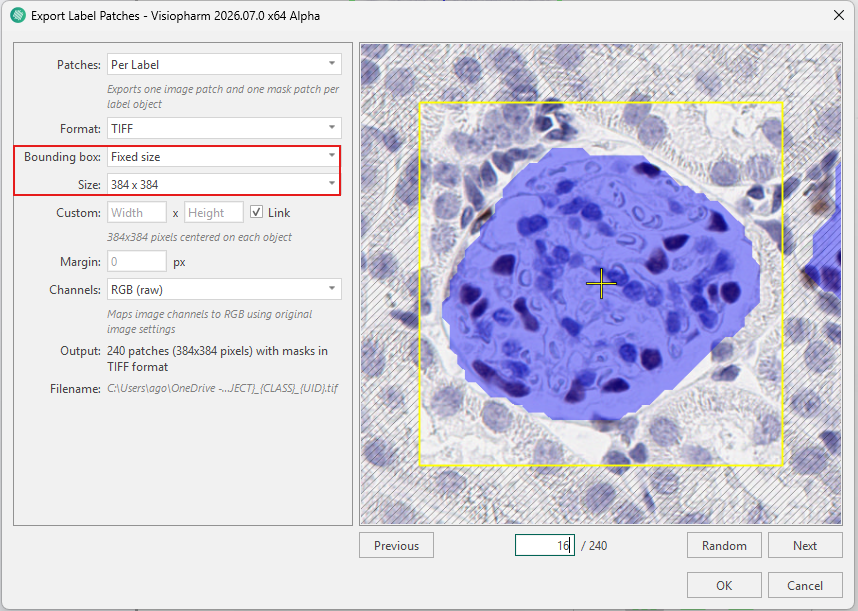 Export Glomeruli Label Patches using Fixed Size Bounding Box.