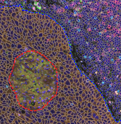 Example of an Original image showing ROIs and cell detection labels prior to TIFF export.
