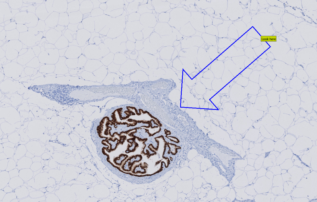 Example of an arrow pointing to a specific object