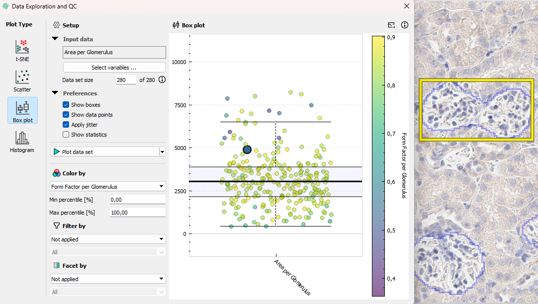 Using Color by to find correlations can also reveal outliers (Glomeruli CD68 staining).