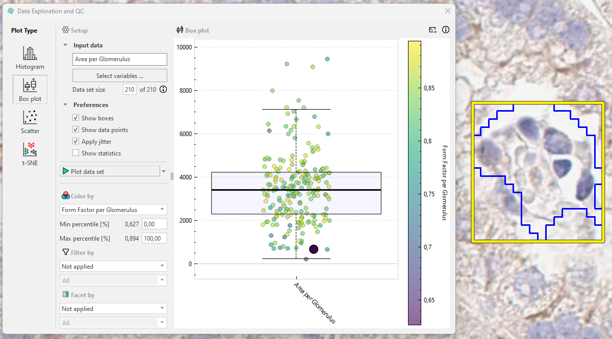 Using Color by to find correlations can also reveal outliers (Glomeruli CD68 staining).