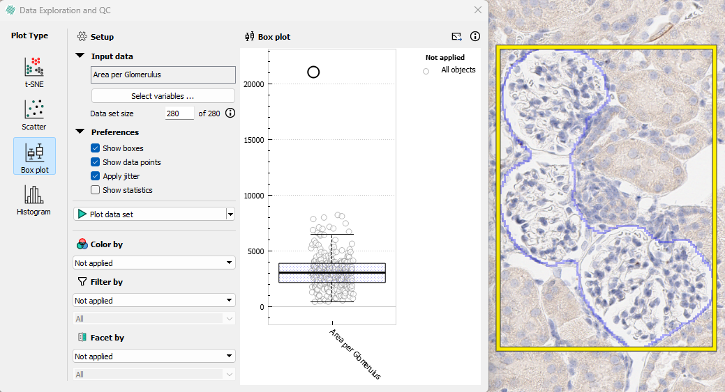 Clicking on the outlier will zoom to its location (Glomeruli CD68 staining).