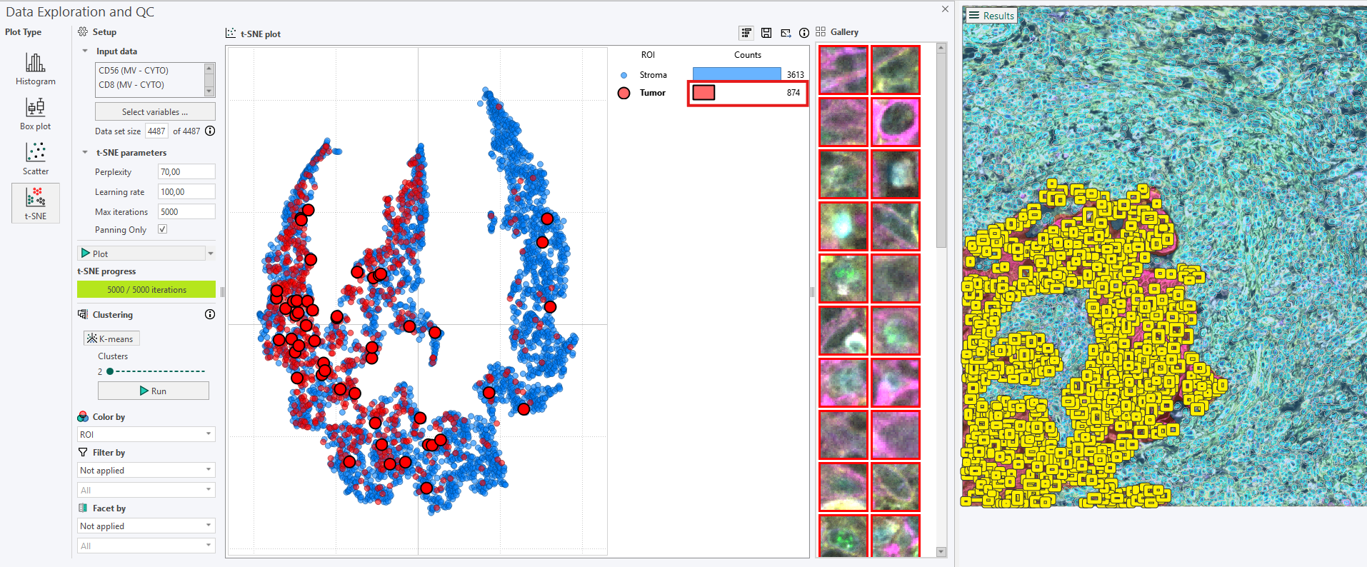 Highlighting all Tumor cells in the image and a random sample in the t-SNE plot and Gallery.