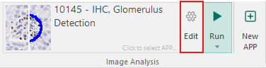 Editing the 10145 - IHC, Glomerulus Detection APP