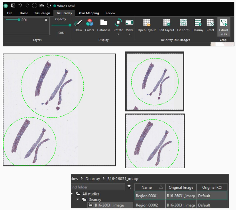 Pressing the 'Extract ROIs' button will crop the ROIs into separate images and save them to a folder in the database.