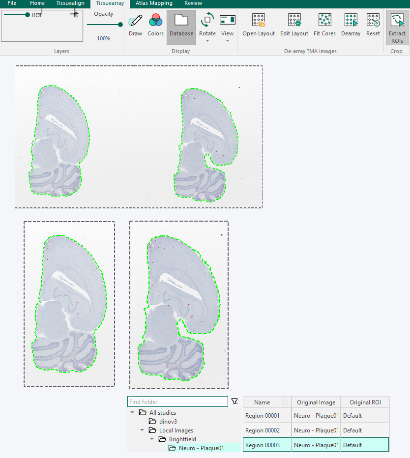 Pressing the 'Extract ROIs' button will crop the ROIs into separate images and save them to a folder in the database.