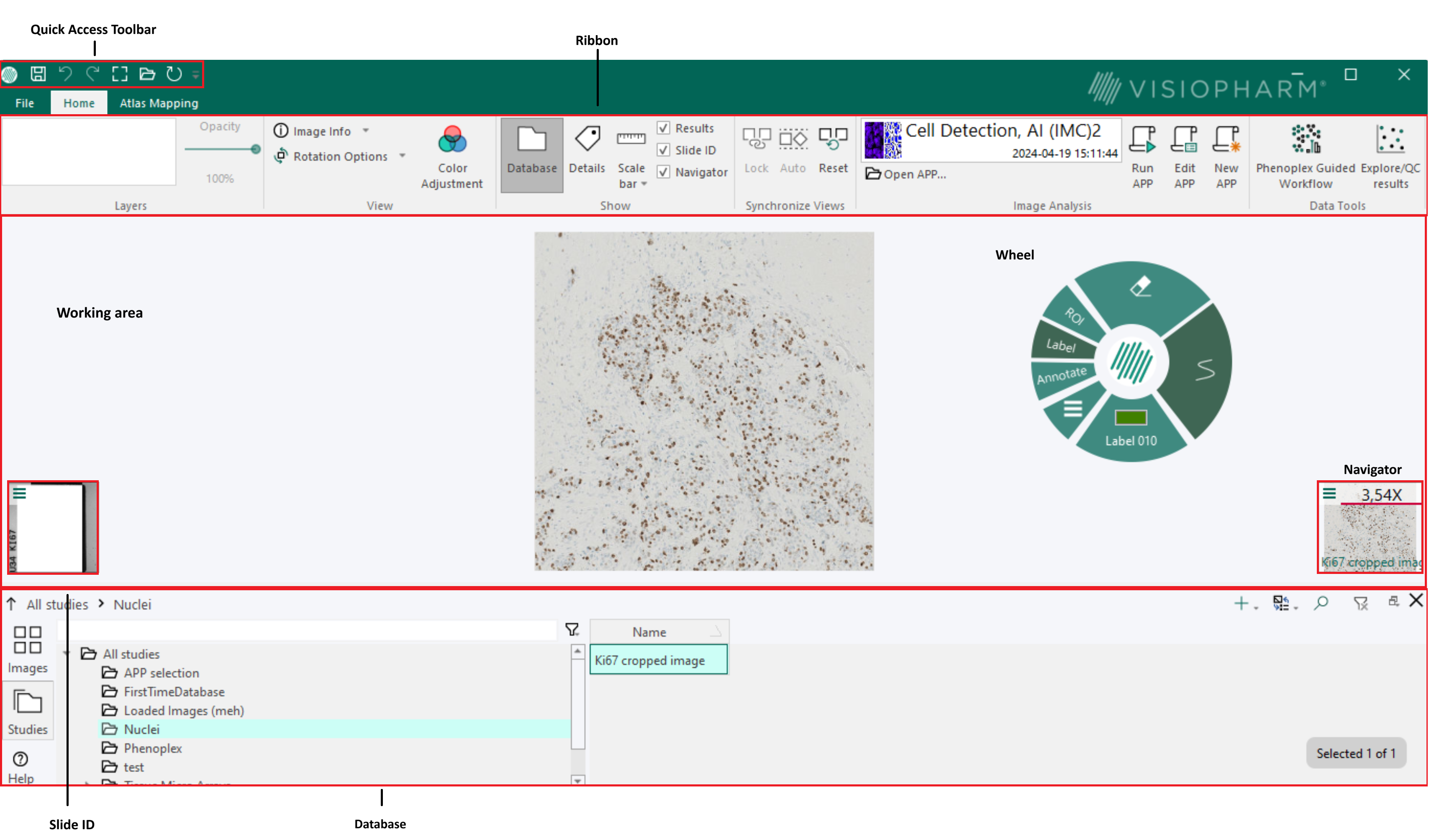 Overview of the user interface