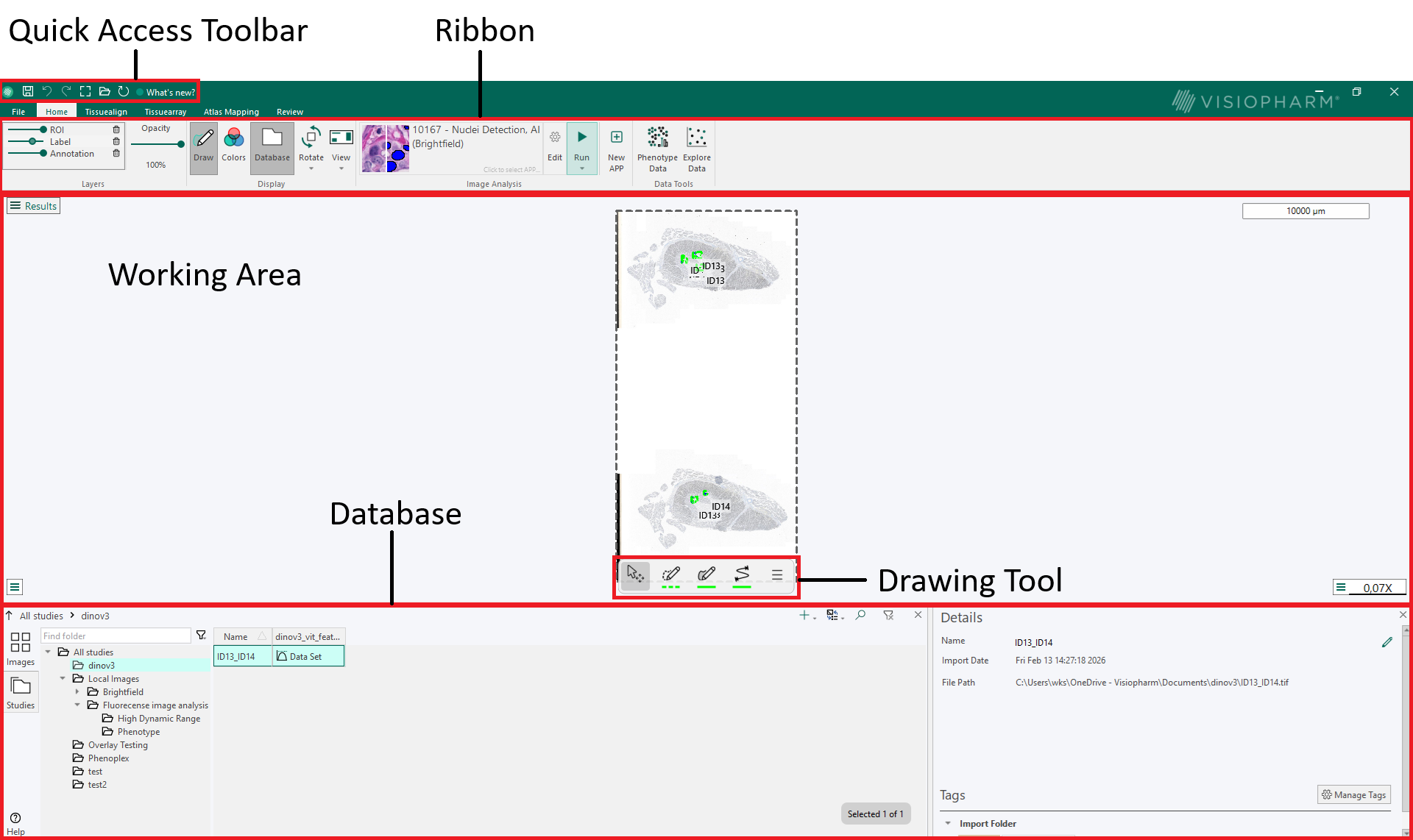 Overview of the user interface