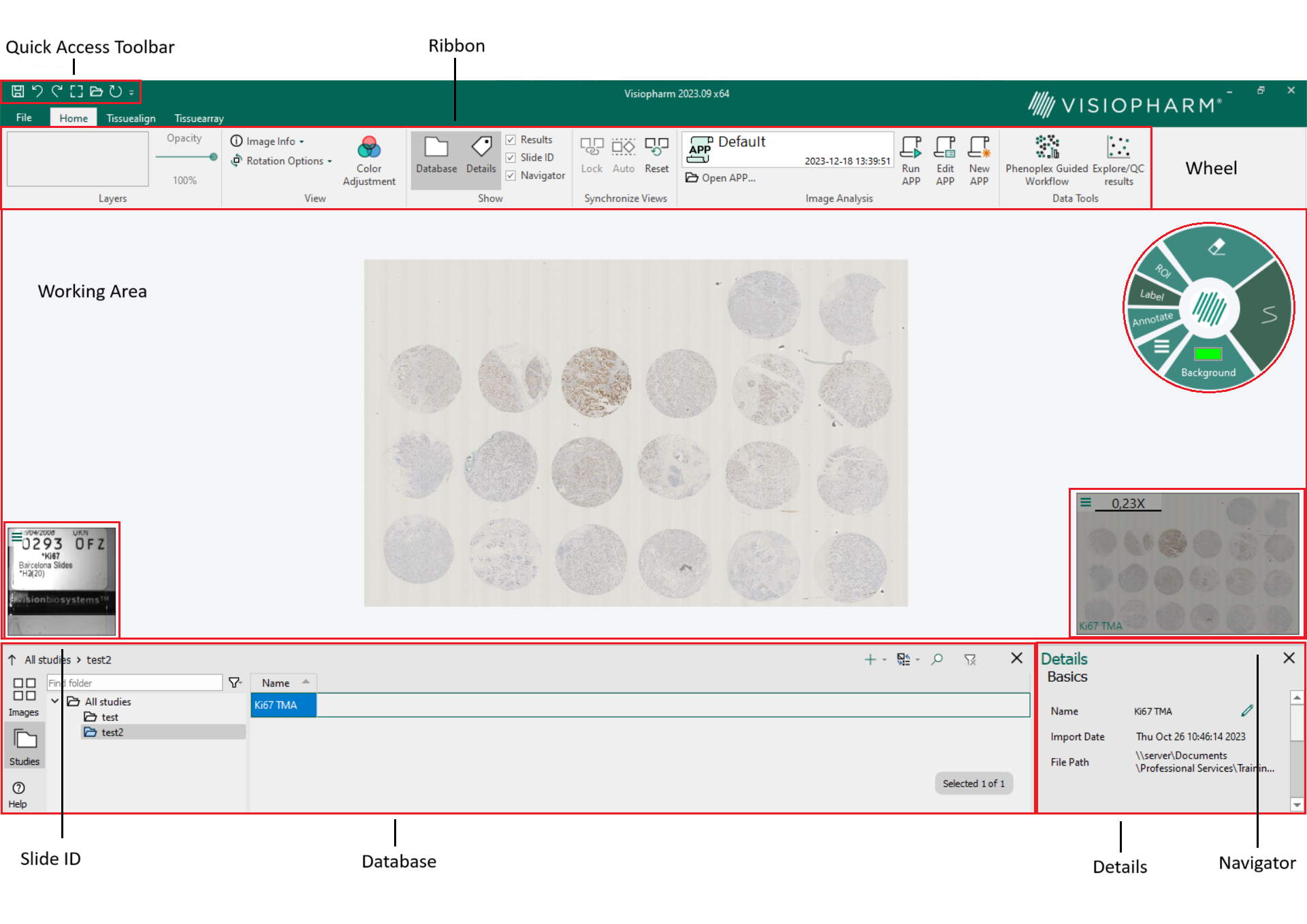 Overview of the user interface
