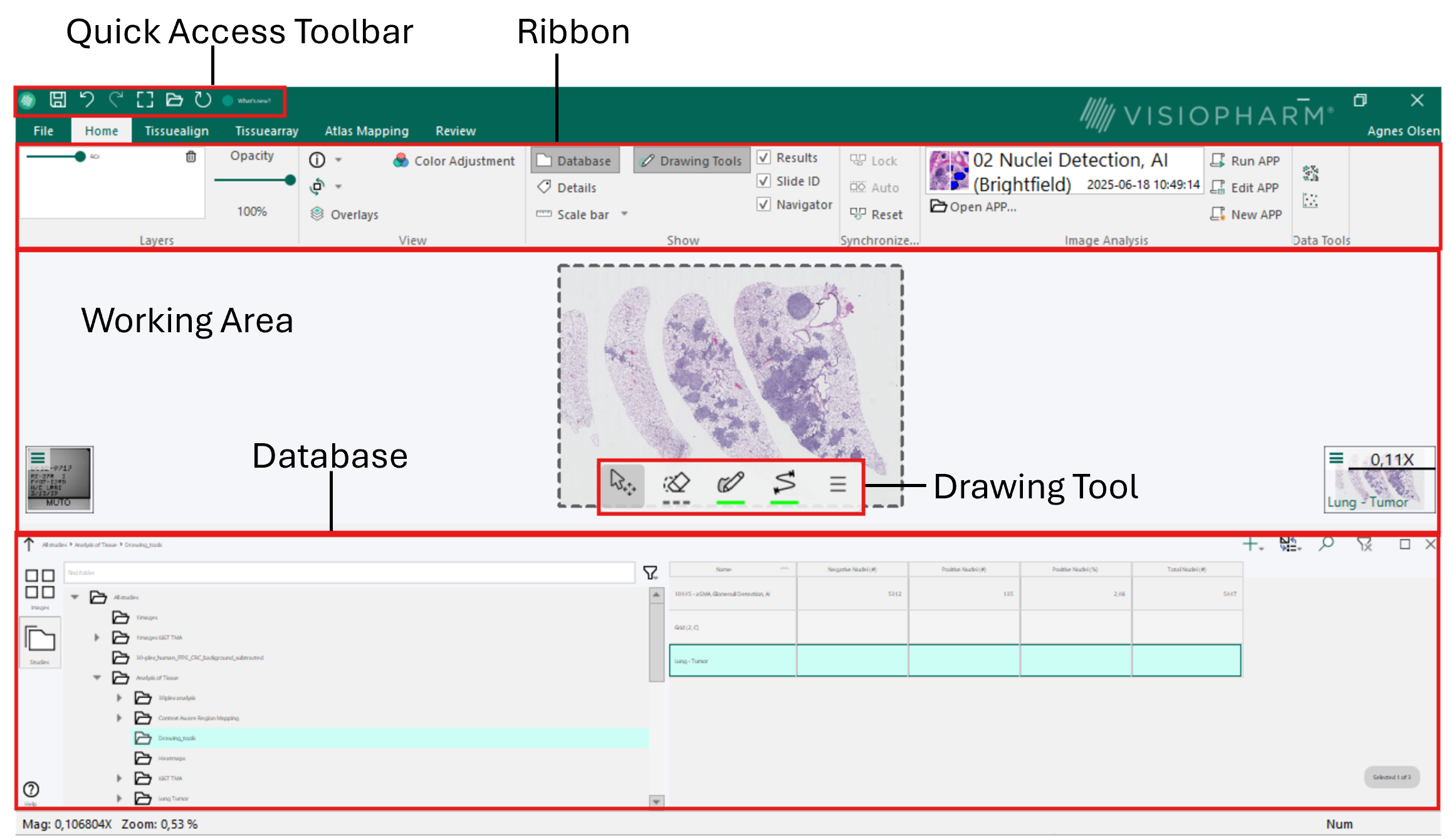 Overview of the user interface
