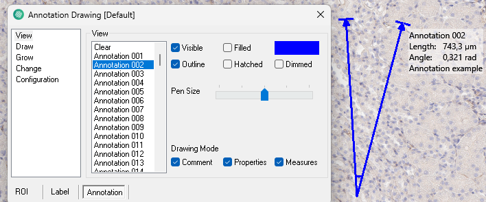 Example showing an annotation when both Comment, Properties, and Measures are ticked on