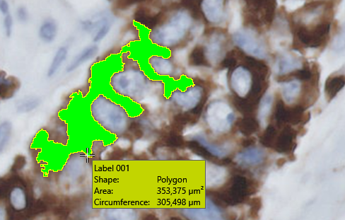 Overlay information (Lung tissue HER2)