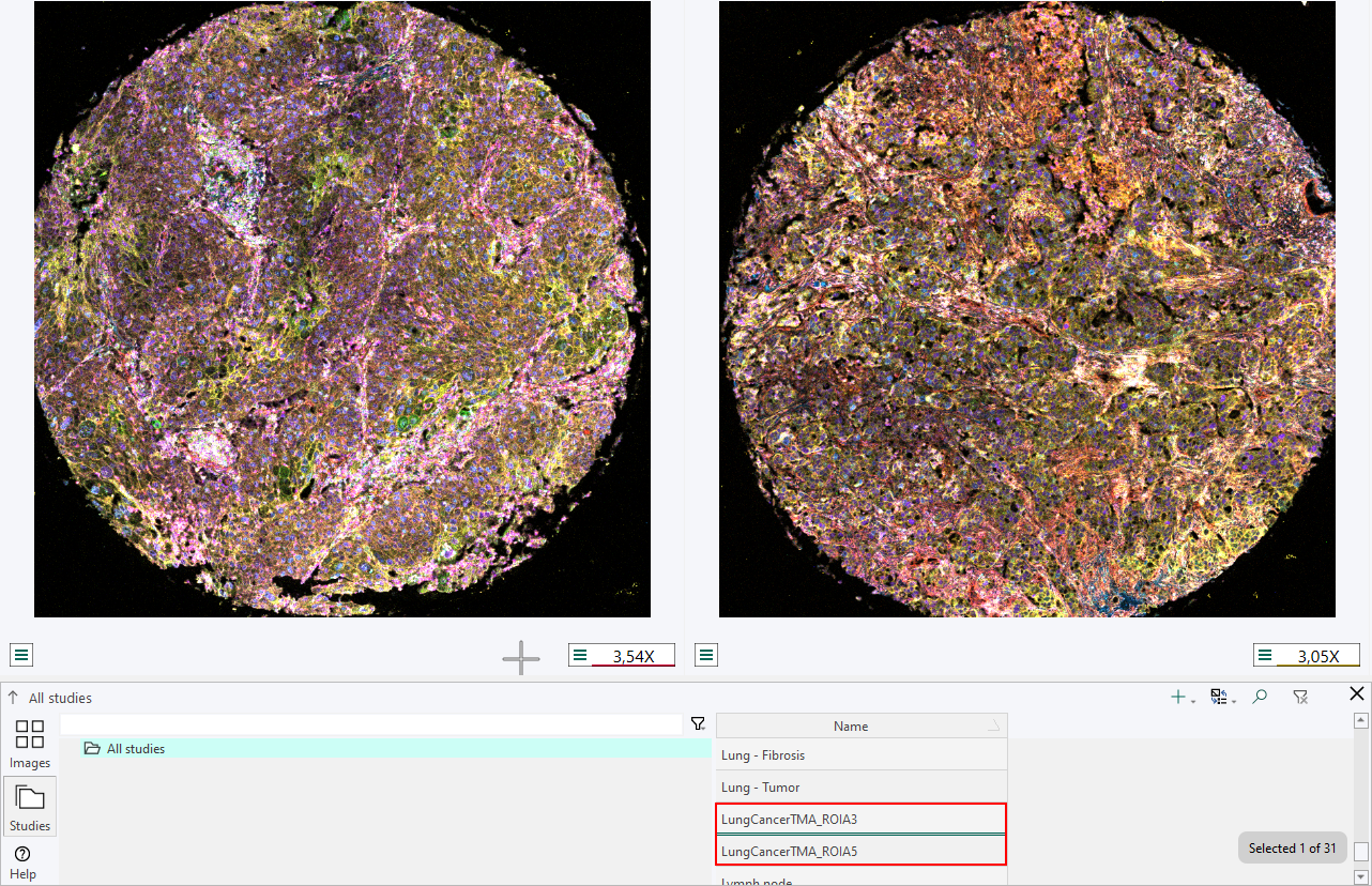Example of two images open simultaneously
