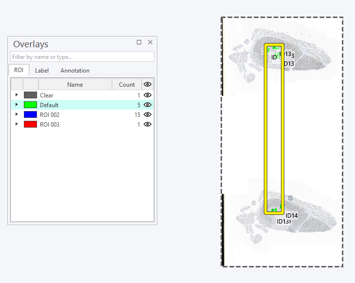 The yellow box shows where the ROI class of 'Default' is located. Every point is within the box