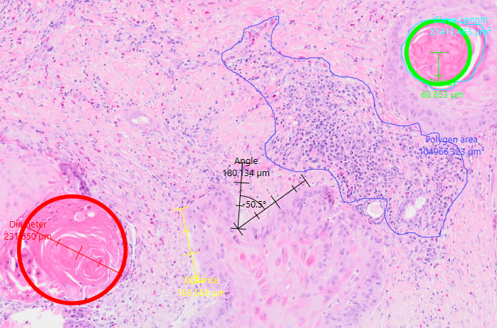 Measurement in Visiopharm 2024.07