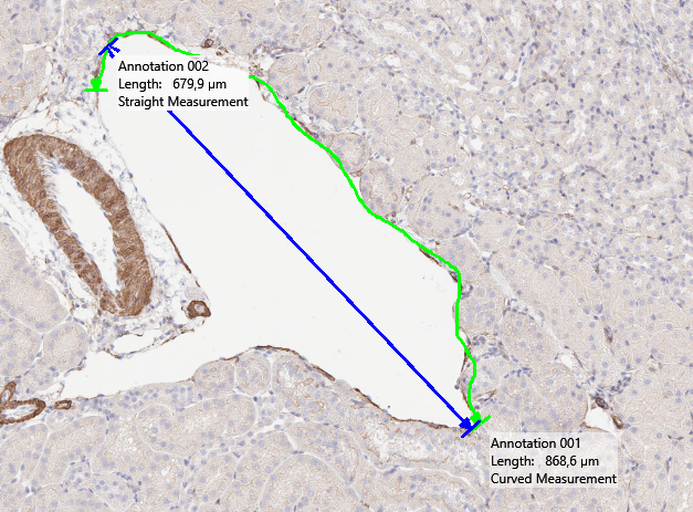Example of measurement with curved and straight lines