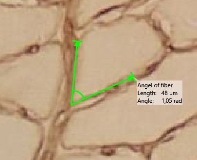 Example of measurement with distance and angle (Muscle fibers)