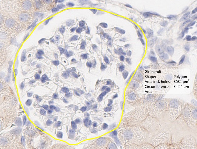 Example of measurement with area (Glomeruli)