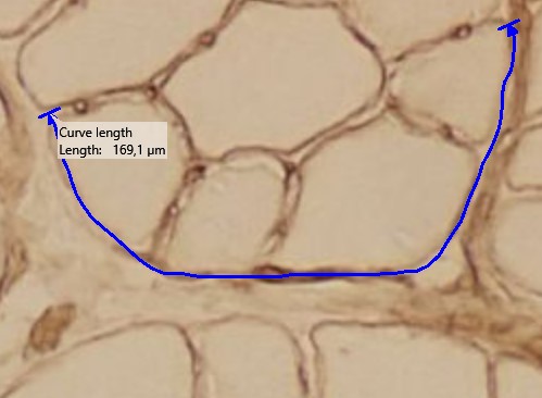 Example of measurement with curve length (Muscle fibers)