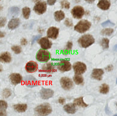 Example of measurement with radius and diameter (Bladder tissue, MCM7 stained)