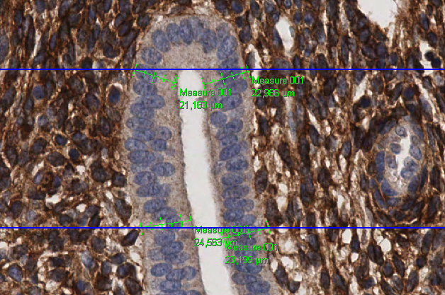 Example of measurement with multiple Distances (Gut epithelium DAB)