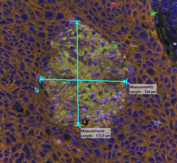 Example of measurement with multiple Distances