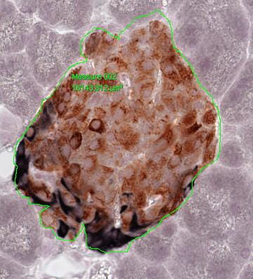 Example of measurement with polygon area (Mouse Pancreas)